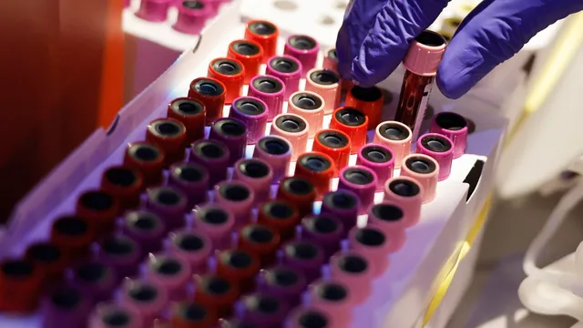 Blood supply crisis declared as donations plummet in the US
