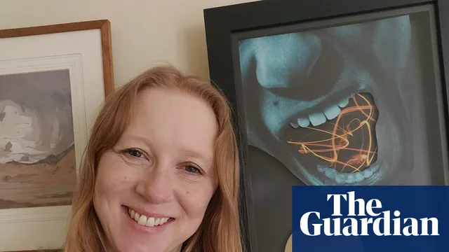 Scatman John inspires a teenager to embrace their stammer