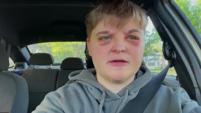 Homophobic attack leaves woman hospitalized after McDonald's incident