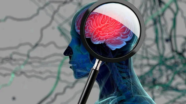 AI tool detects early signs of Alzheimer's through sleep analysis