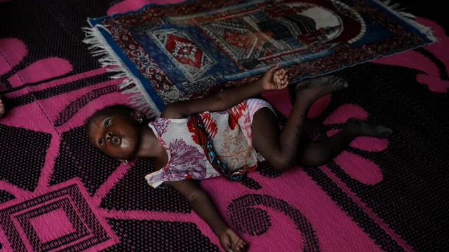 Nigerian families face malnutrition crisis due to Iran war's economic impact
