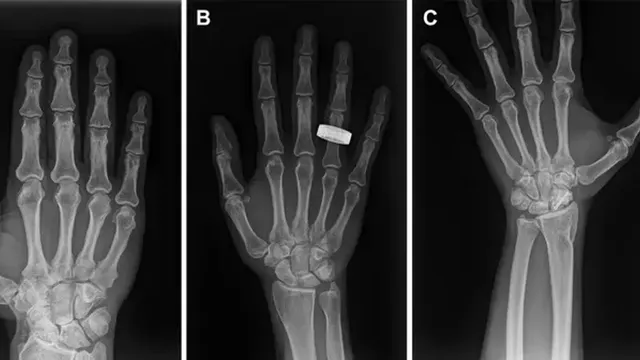 Astronauts successfully perform X-rays in space for the first time