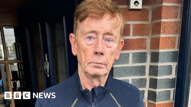 Nurse attacked by masked men in Belfast for her skin color