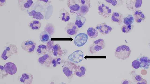 Texas woman dies from brain-eating amoeba after using RV tap water for nasal rinse