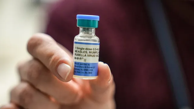 South Carolina battles worst measles outbreak in over 35 years