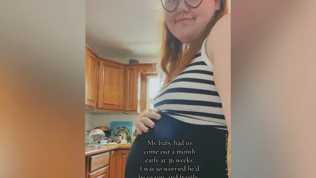 Mother shocked by premature baby's size at birth