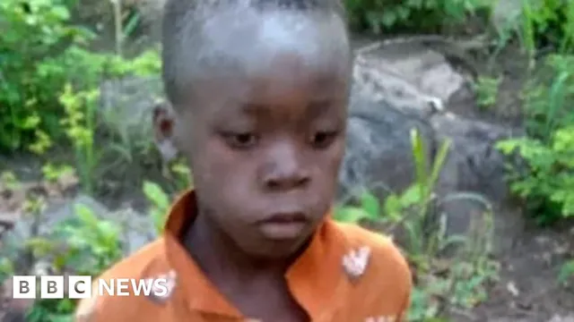 Boy survives five days in lion's grip by foraging for food in Zimbabwe