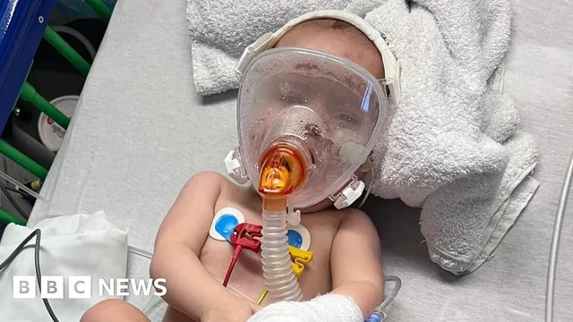 Pregnant women must get RSV vaccination to protect their babies