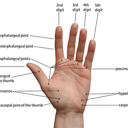 Figure 1. View of the hand showing the anatomical terminology used in the text