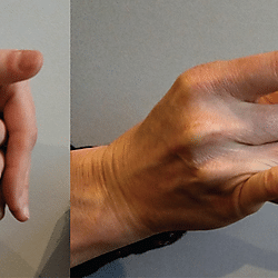 Figure 5. Flattening the cylinder gesture
